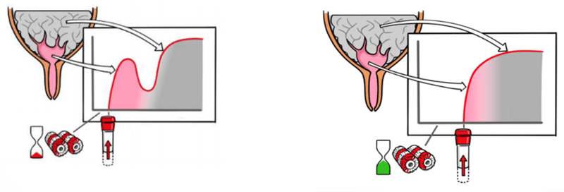 Milking without vs. with pretreatment